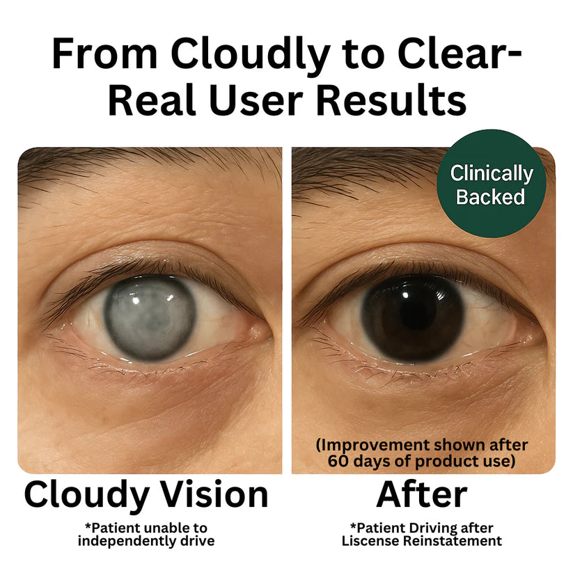 Advanced Eye Shield Capsules